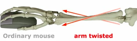 pronation of upper arm 